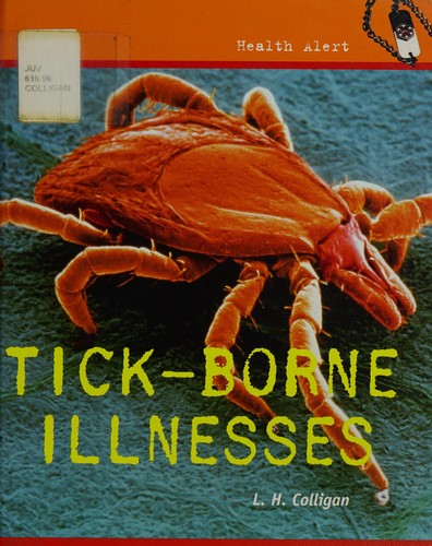 Tick-borne illnesses