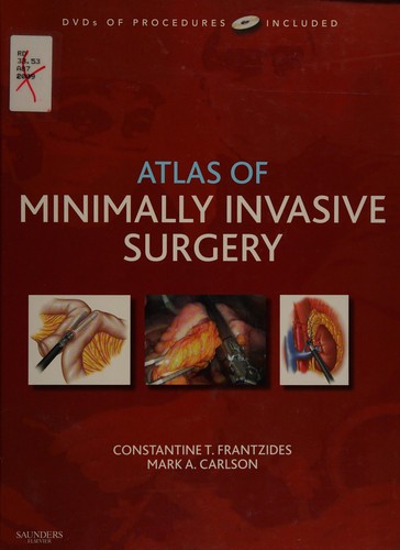 Atlas of minimally invasive surgery