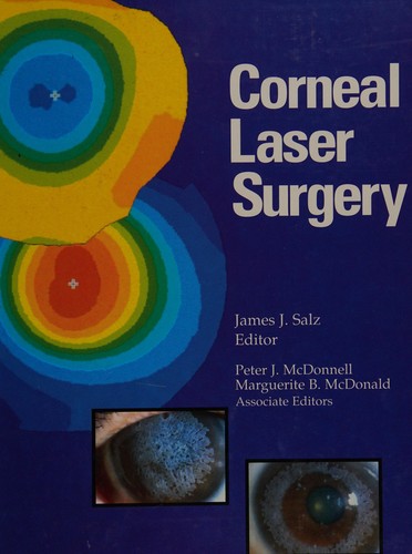 Corneal laser surgery