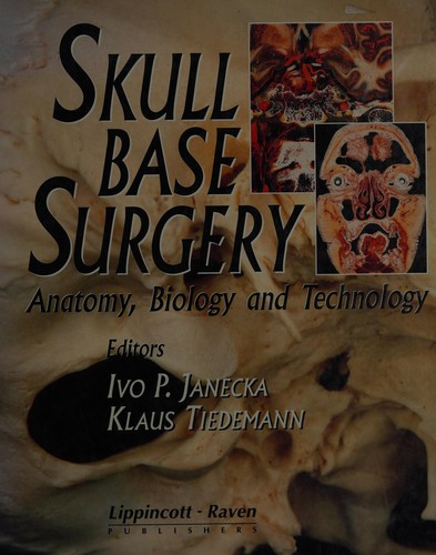 Skull Base Surgery