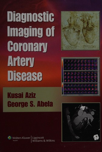 Diagnostic imaging of coronary artery disease