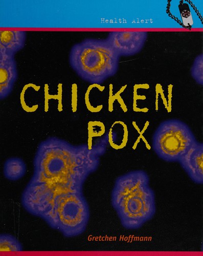 Chickenpox