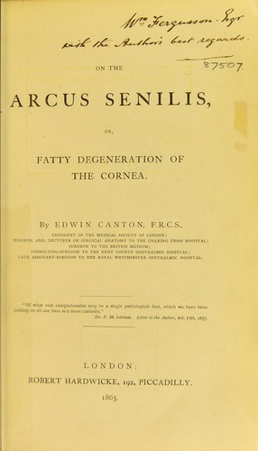 On the arcus senilis