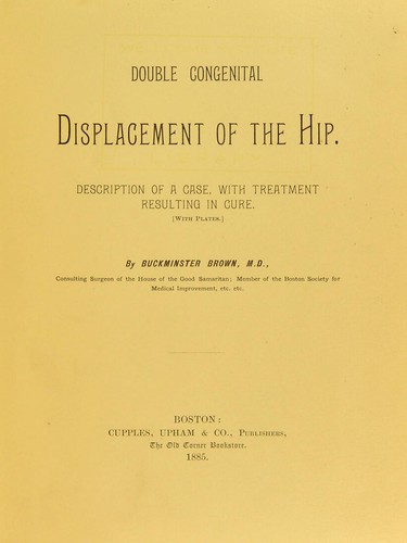 Double congenital displacement of the hip