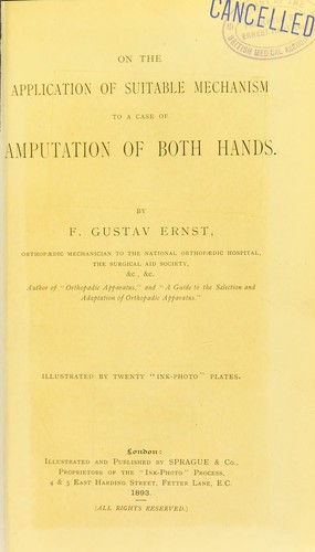 On the application of suitable mechamism to a case of amputation of both hands