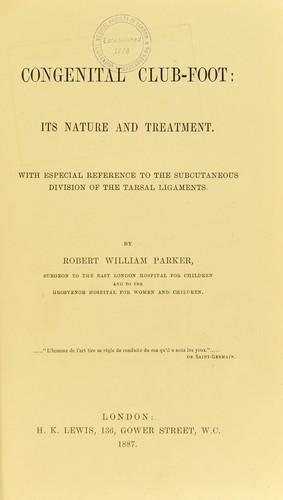 Congenital club-foot