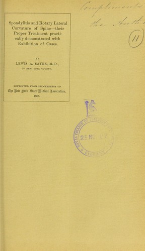 Spondylitis and rotary lateral curvature of spine