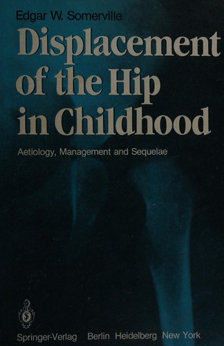 Displacement of the hip in childhood