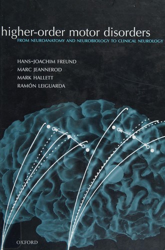 Higher-order motor disorders