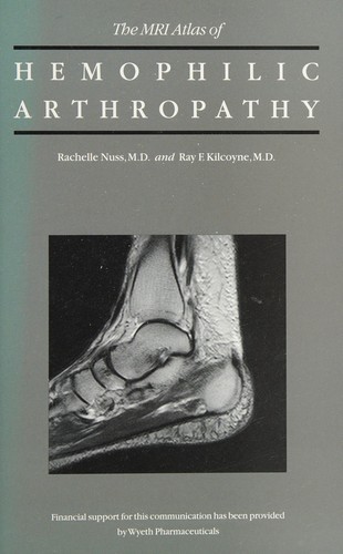 The MRI atlas of hemophilic arthropathy