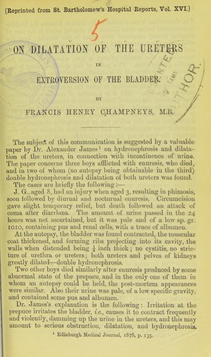 On dilatation of the ureters in extroversion of the bladder