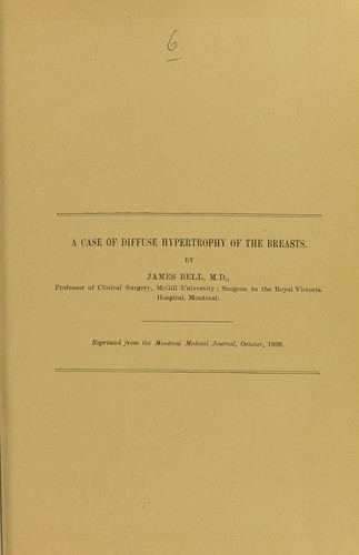 A case of diffuse hypertrophy of the breasts