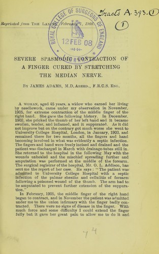 Severe spasmodic contraction of a finger cured by stretching the median nerve
