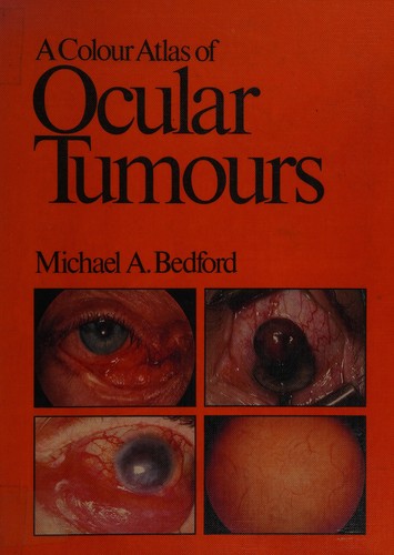 A Colour Atlas of Ocular Tumors (Wolfe Medical Atlases)
