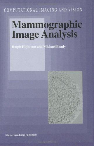 Mammographic image analysis