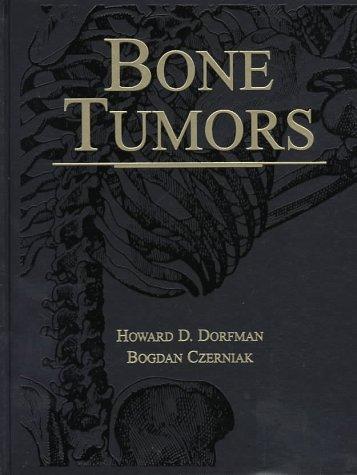 Bone tumors