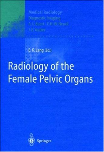 Radiology of the female pelvic organs