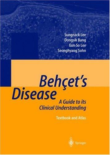 Behcet's Disease