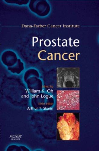 Prostate Cancer