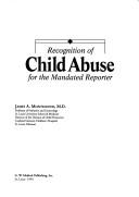 Recognition of child abuse for the mandated reporter