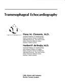Transesophageal echocardiography