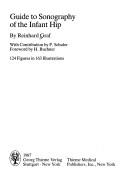 Guide to sonography of the infant hip