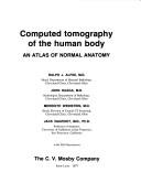 Computed tomography of the human body