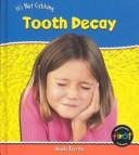 Tooth Decay