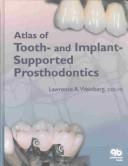 Atlas of Tooth- And Implant-Supported Prosthodontics