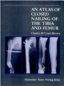 An atlas of closed nailing of the tibia and femur