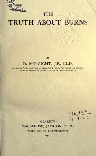 The truth about Burns.