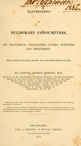 Illustrations of pulmonary consumption