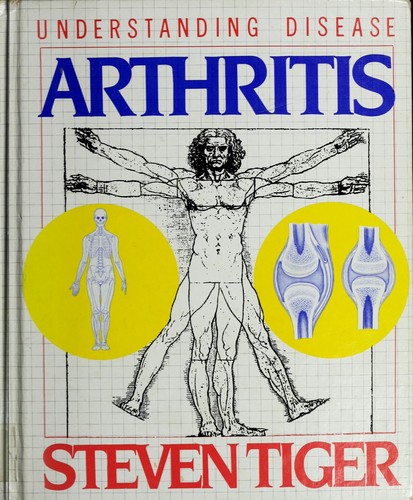 Arthritis