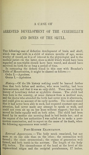 A case of arrested development of the cerebellum and the bones of the skull in a child