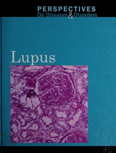 Lupus