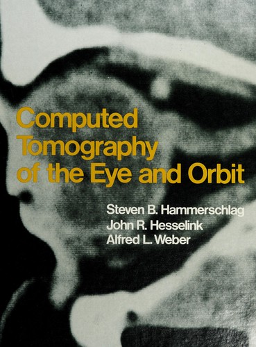 Computed tomography of the eye and orbit