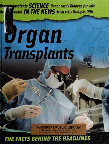 Organ transplants